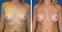 Before & After Photos